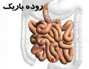 [تصویر:  Small-Intestine-Cancer.jpg]