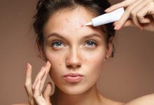 7 دلیل لکه های ناگهانی روی پوست و 6 درمان موثر