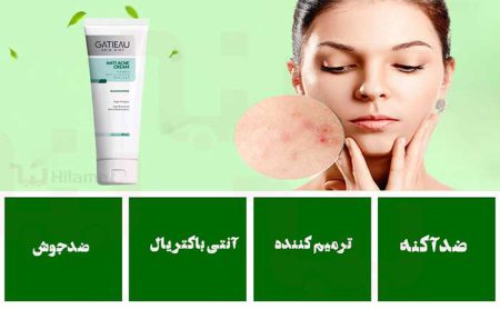 4 ویژگی اصلی پماد نوروژن