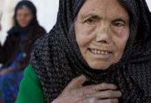 22 وحشتناک ترین بیماری ها (سخت ترین بیماری های جهان+عکس)
