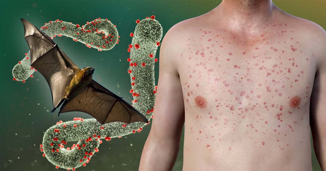 ویروس ماربورگ (Marburg Virus)